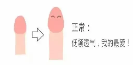孩子包皮过长一定要切吗？ | 艾自由网 | ifree6.cn
